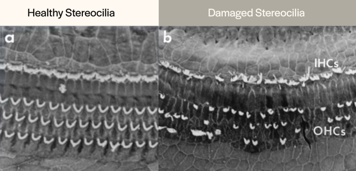 Healthy vs damaged steocilia