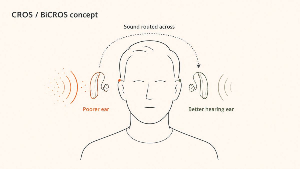 Diagram showing how CROS and BiCROS hearing aids route sound to the better hearing ear