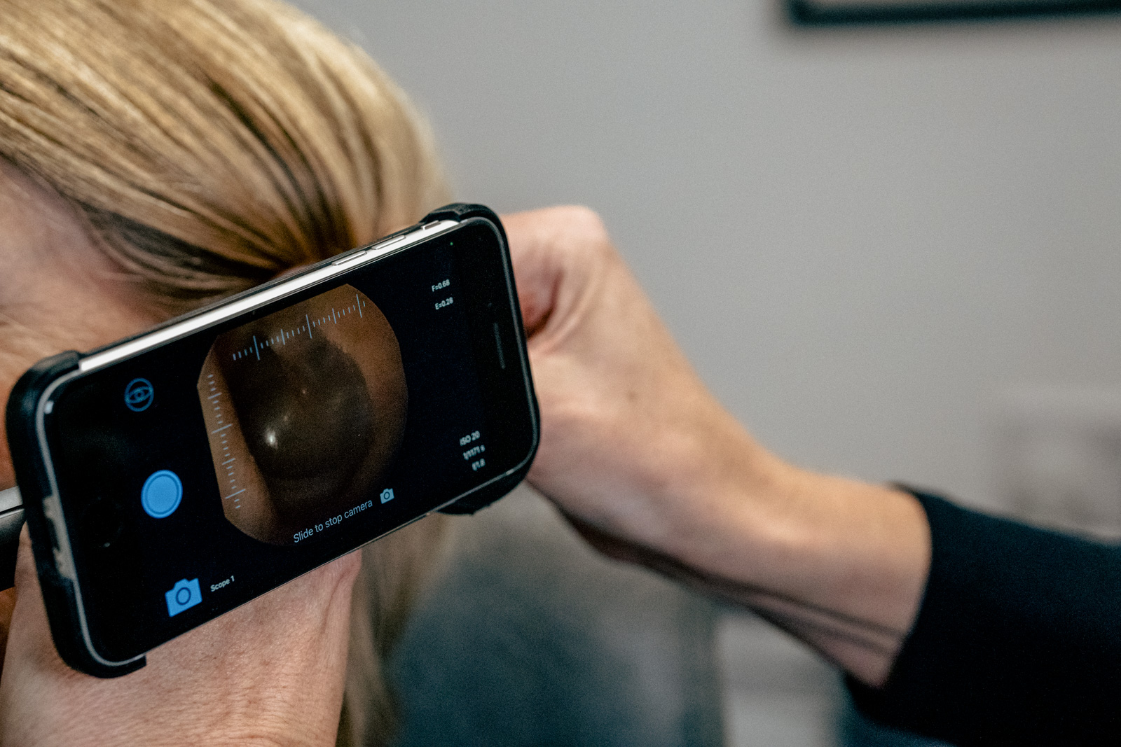 Video otoscope displaying the inside of an ear during an ear-health check at Alto Hearing