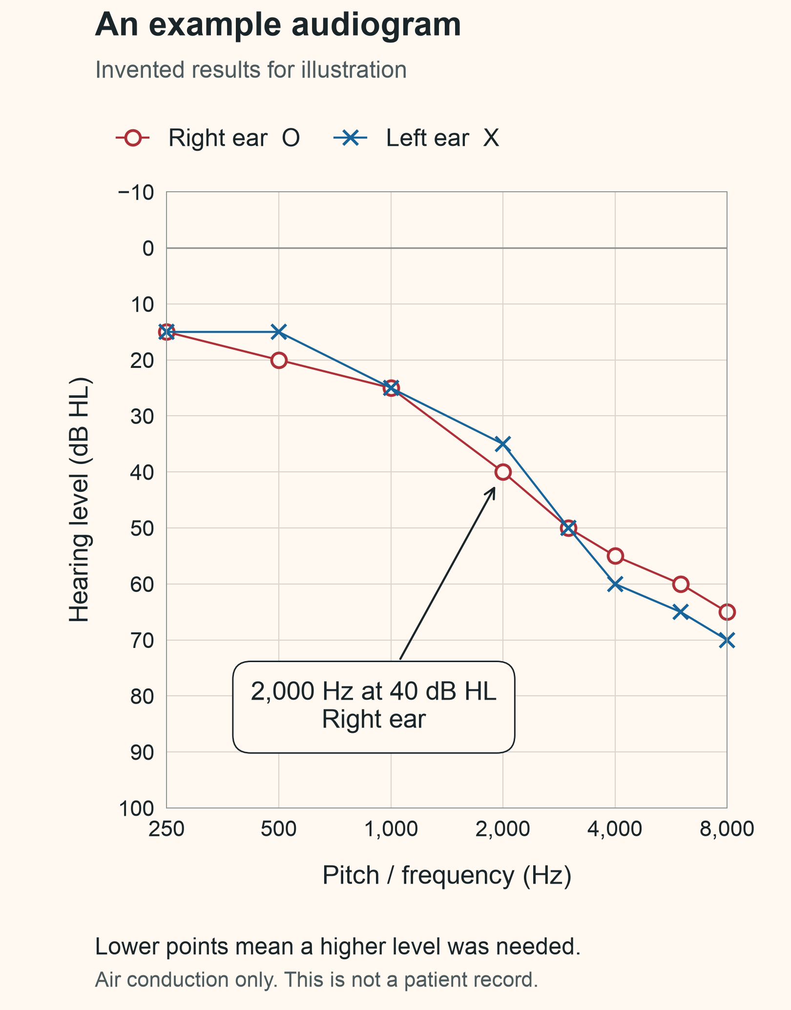 Illustrative audiogram with right-ear circles and left-ear crosses. The right-ear threshold at 2,000 Hz is 40 dB HL.